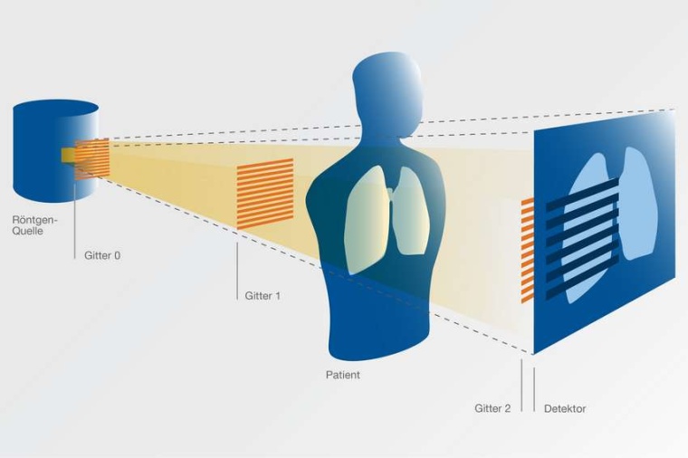 Abb.: Gitter ermöglich, das gestreute Röntgenlicht zu nutzen: Sie sind für...